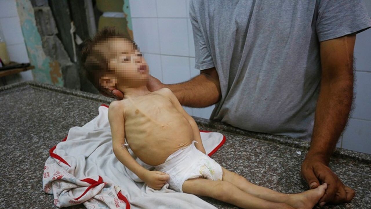 Dünyanın Önde Gelen Soykırım Uzmanları: İsrail'in Gazze'deki Savaşı Soykırım Tanımına Uygun