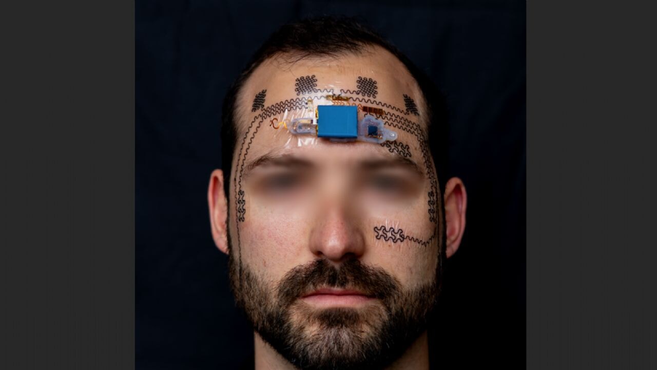 Fazla çalışınca alarm veren elektronik dövme