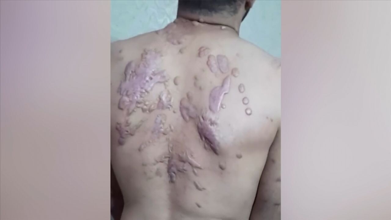 Dünya, İsrail'in Filistinlilere yaptığı işkenceleri seyrediyor!