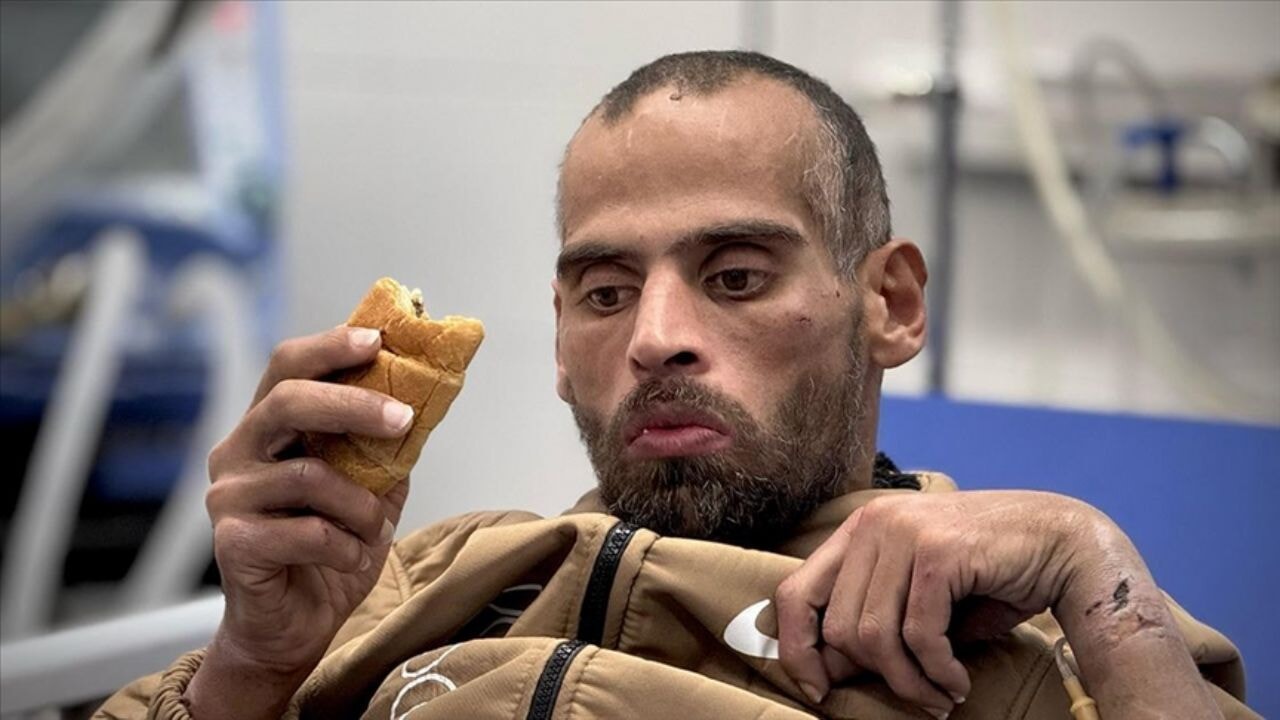 Filistinli esir, İsrail işkencesinden sonra konuşamıyor. İsrail'in korkunç yüzü