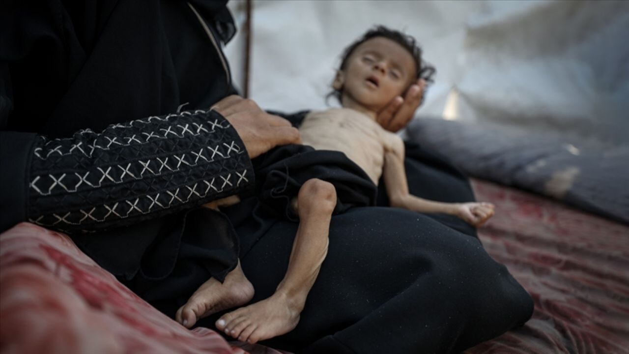 Gazze'de açlık had safhada! Can Kaybı 61 bin 430'a yükseldi