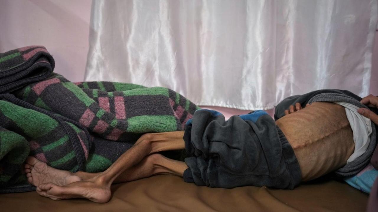 Gazze'de açlık: Hemşireler bayılıyor, bebekler ölüyor