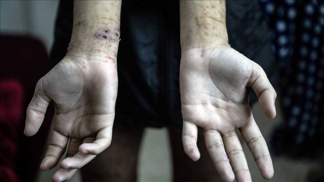 Gazzeli tutuklulara İsrail hapishanelerinde sistematik işkence