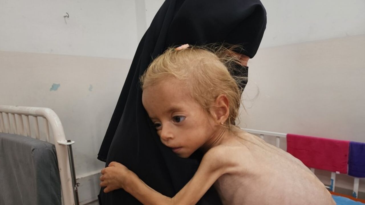 İsrail'in Gazze ablukası altında açlık nedeniyle ölümler artıyor