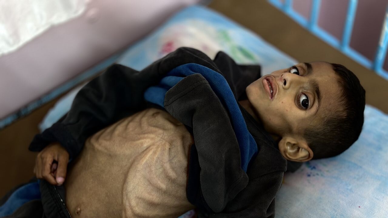 Lazzarini: Gazze'de çocuklar açlıktan ölüyor