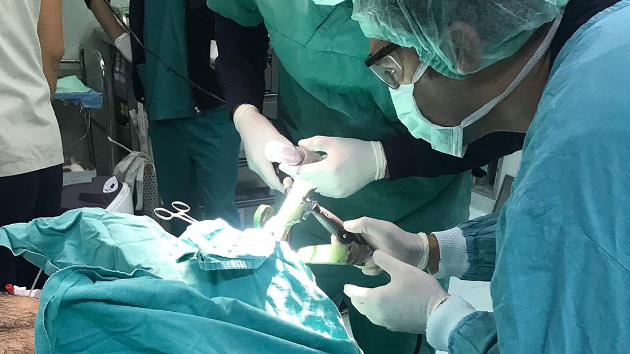 Ölü kalp yeniden çalıştırıldı