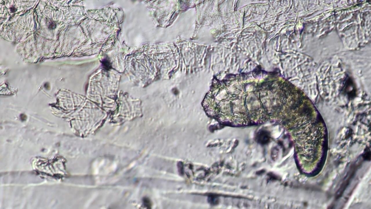 Siz uyurken yüzünüzdeki canlılar iş başında