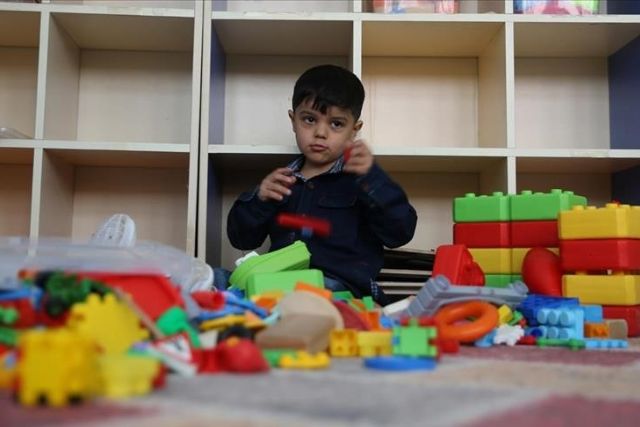 Baby prosthetic leg image