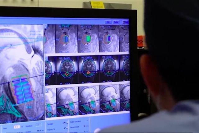 Canadian doctors pioneer medical procedure to treat inoperable brain tumor