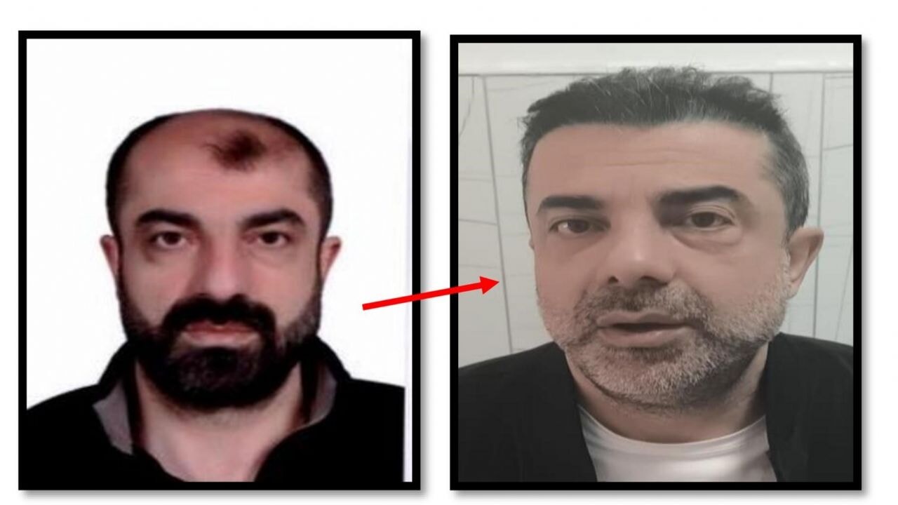 Ameliyat ile yüzünü değiştiren firari cinayet zanlısı yakalandı