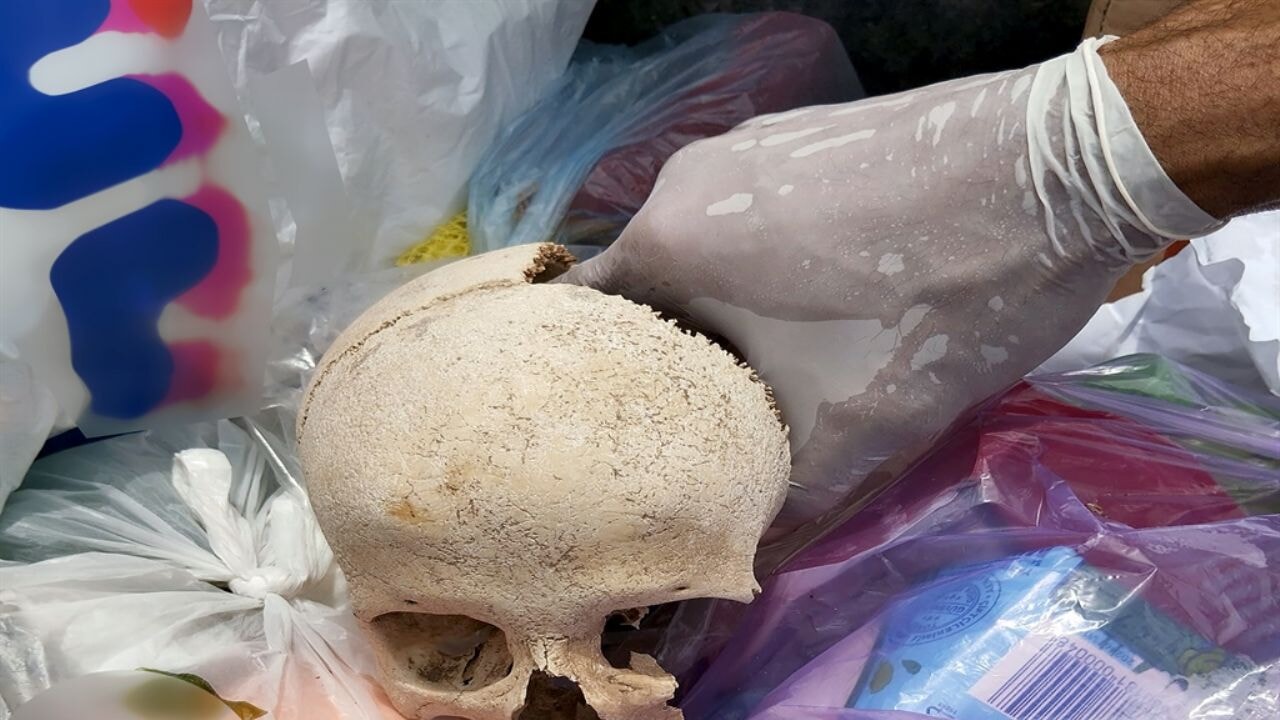 Çöpte bulunan kafatasıyla ilgili gerçek ortaya çıktı