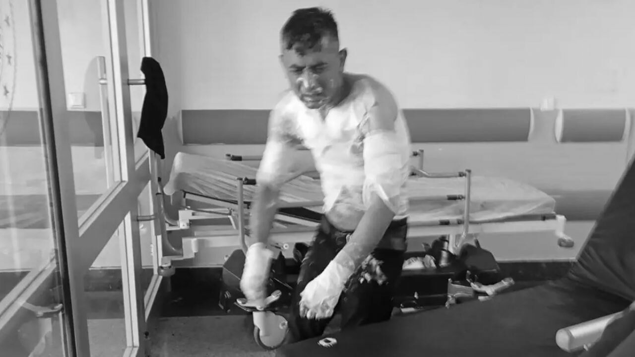 Gaziosmanpaşa'da engelli bir adam kimyasal maddeyle yakıldı