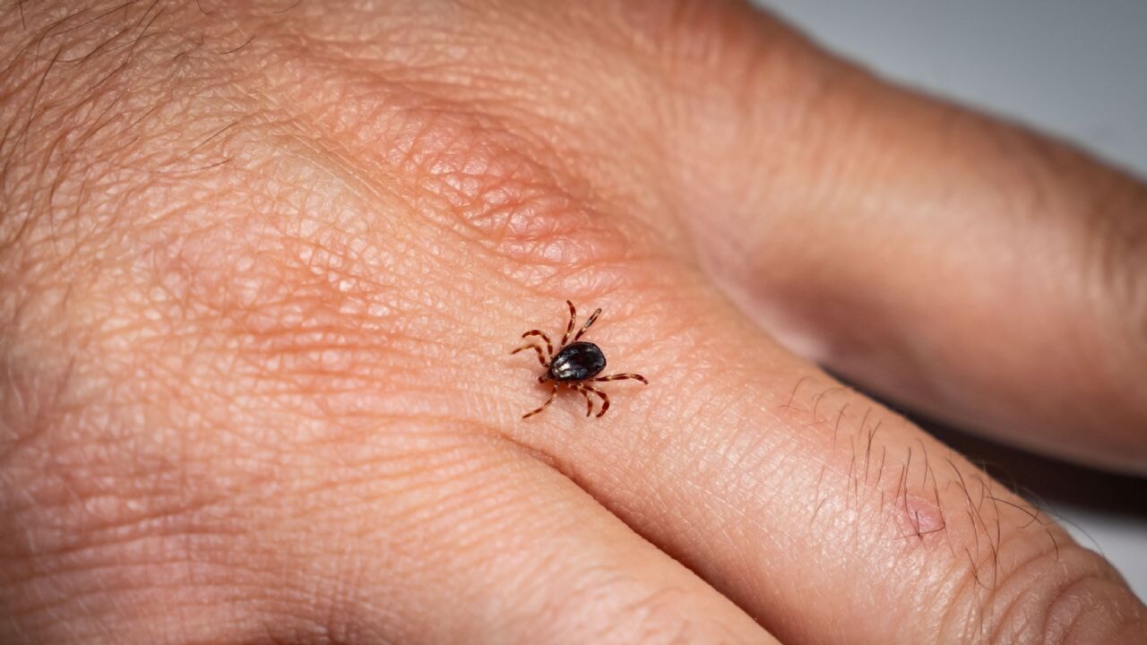 Kene ısırıklarına karşı altın kural: Hemen çıkarın