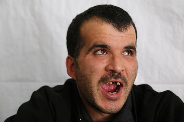 Esed'in askerleri dişlerini bile söktü