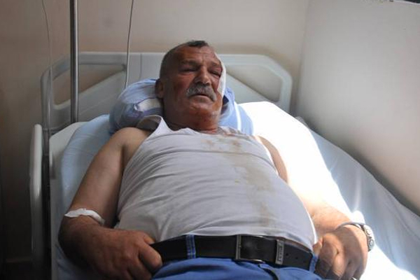 HDP saldırısında yaralananlar konuştu