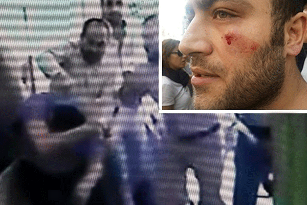 AK Partili vekilin elini sıkmadı, dayak yedi iddiası