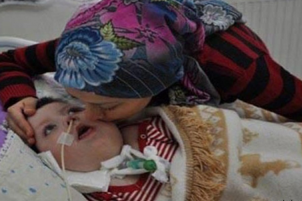 Soma faciasının ardından ikinci kayıp