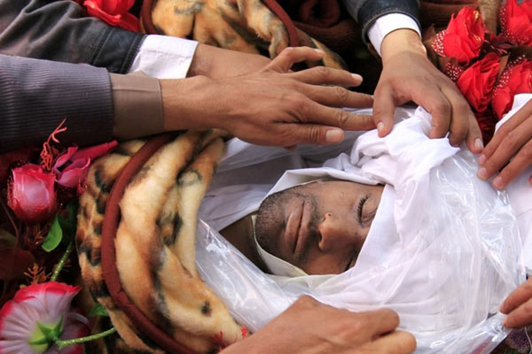 Yemen'de katliam gibi bilanço