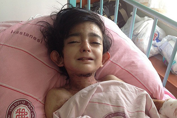 Elfida'nın elleri artık kalem tutacak