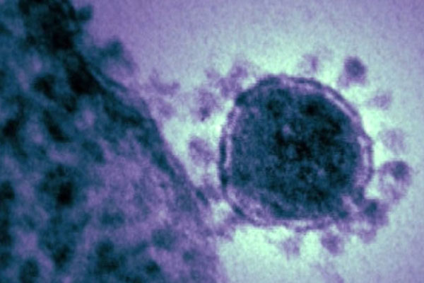 Güney Kore'de ’MERS’ alarmı: 7 ölü