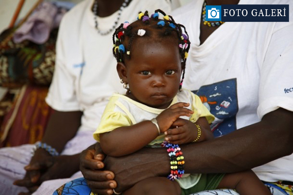 TİKA’dan Senegal’de sağlık taraması