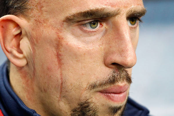 Ribery'yi yıkan haber