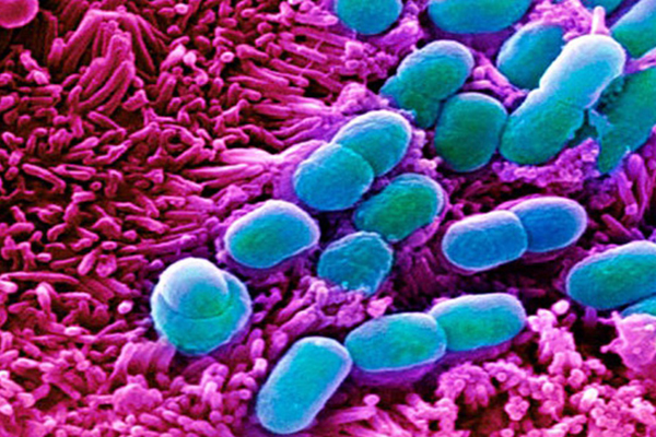 Romanya'da yenidoğan 39 bebeğe 'süper bakteri' teşhisi