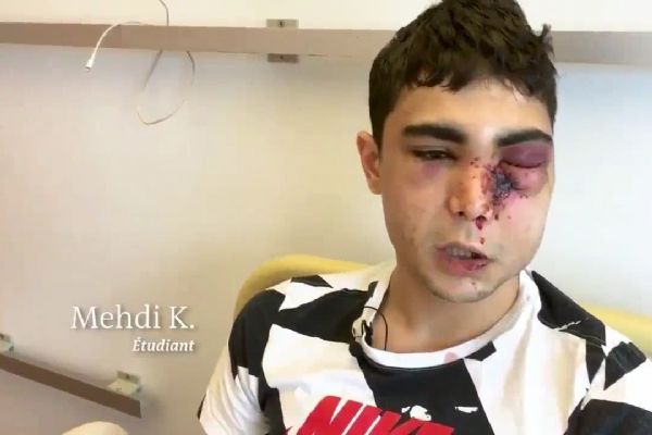 Fransa polisinin öldüresiye dövdüğü 'Sarı Yelekli' genç