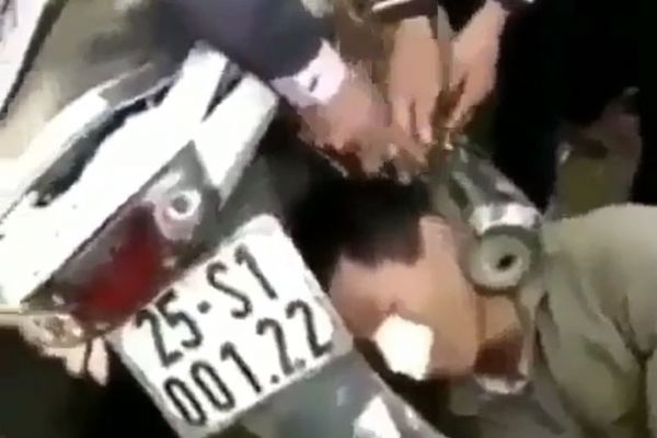 Kafası motosikletin tekerleği ve egzozu arasına sıkıştı