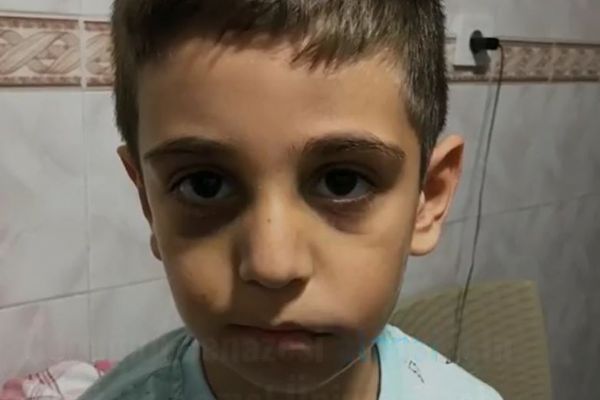 Babası tarafından 'ödevini yapmadığı için' dövülerek komalık olan 6 yaşındaki Mertcan hayatını kaybetti