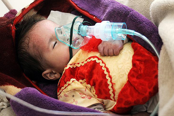 Dünya Sağlık Örgütü: Yemen'de sağlık tesislerinin yarısı hizmet veremiyor