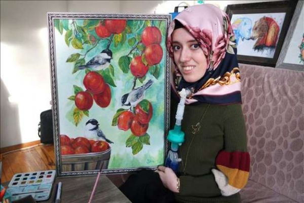 Kas hastası genç kız umutlarını tuvale yansıtıyor