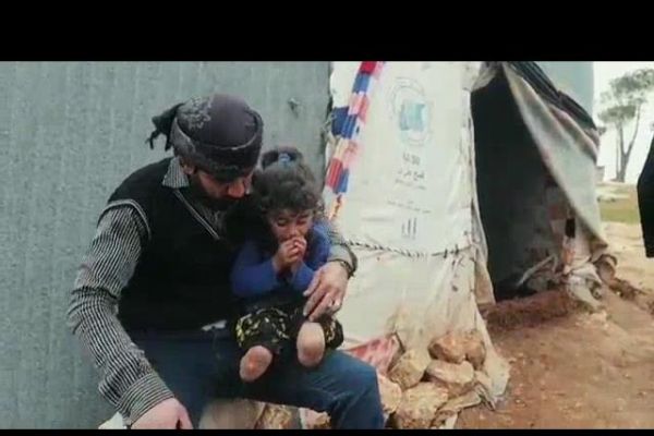 Esed füzeleri iki bacağını parçaladığında henüz 15 aylıktı