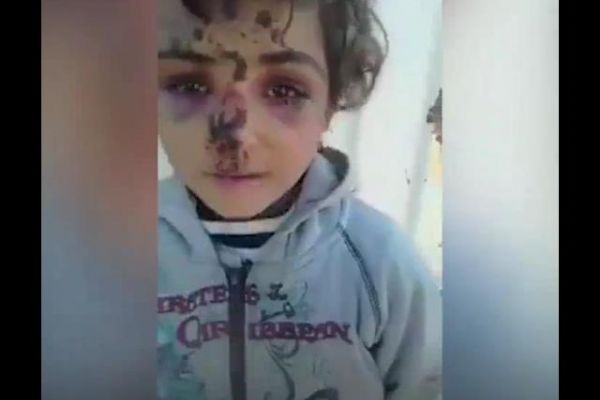 ABD öncülüğündeki koalisyon uçakları Küçük Ömer'in evini yerle bir etti