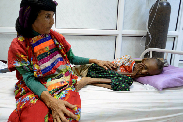 ''Yemen'de 6 binden fazla çocuk öldü veya yaralandı''