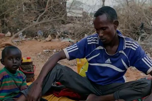 56 milyon kişi acil gıda yardımına muhtaç