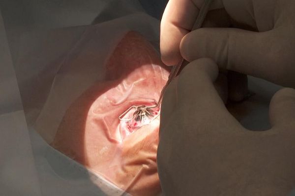 Bilim insanları kendi kendine şekil alan kornea üretti