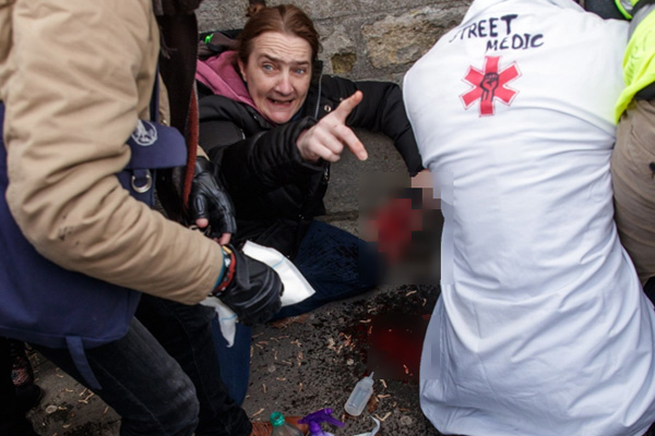 Sarı Yelekliler’in protestosu 13. haftada: Polisin attığı bomba sonucu göstericinin eli koptu