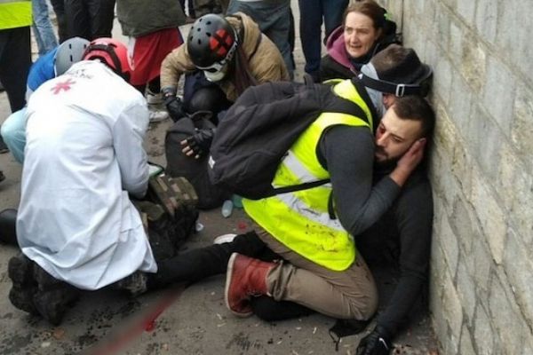 Fransa'daki Sarı yelekli protestosunda bir eylemcinin eli parçalandı