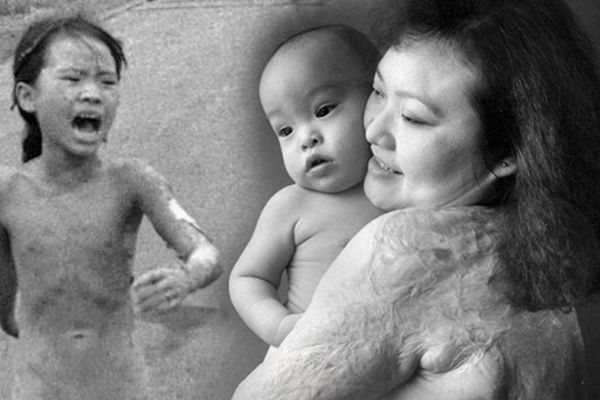 Vietnam savaşının simgesi olan küçük kız: Savaşa ihtiyacımız yok