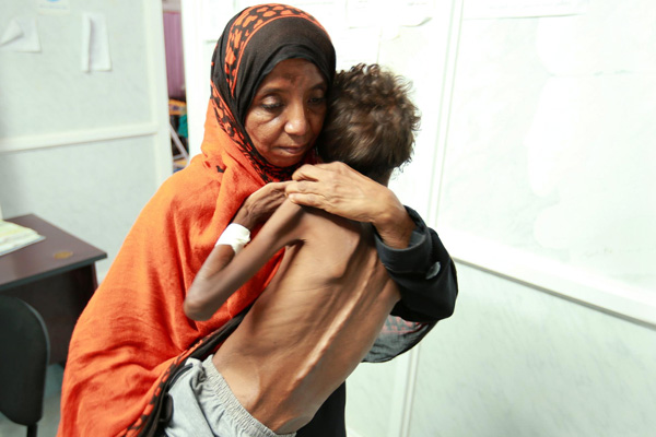 Yardım tırları durduruldu, kıtlık ve hastalık her yerde... BM'den Yemen için '5 hedef' açıklaması
