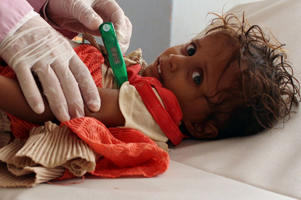 Yemen'de tehlike büyüyor: İki buçuk ayda 109 bin kolera vakası