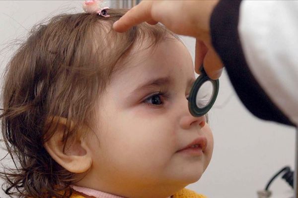 'Glokom' bebeklik döneminde de görülebiliyor