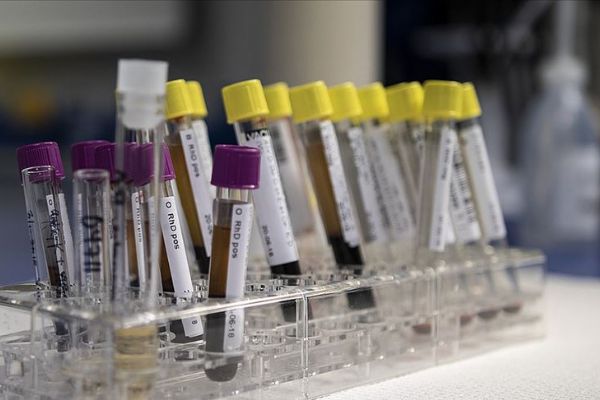 'Hemofilide sağ kalım süresi sağlıklı bireylerle benzer'