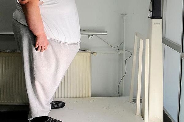 Obezitesi olanlar çareyi 6 yıl sonra hekimde arıyor