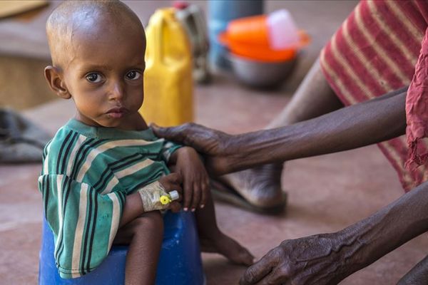 Somali'de gıda sorunu hızla büyüyor