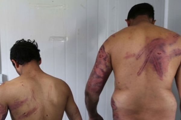 'Yunanistan'a geçen düzensiz göçmenler dövülerek Türkiye'ye atıldı'