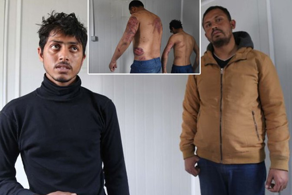 Yunan polisi Pakistanlı göçmenleri dövüp Türkiye'ye gönderdi