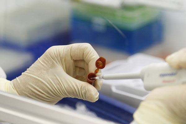 Domuz gribi 4 ilde görüldü