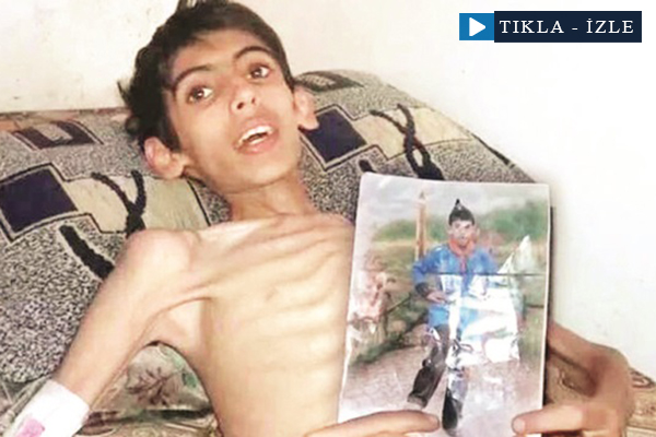 Madaya açlıktan ölüyor